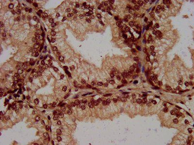 HIST1H3A (Ab-64) Antibody