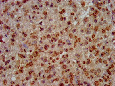 HIST1H3A (Ab-64) Antibody