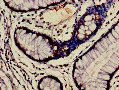 HIST1H3A (Ab-9) antibody