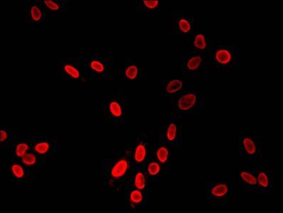 HIST1H3A (Ab-9) antibody