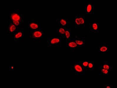 HIST1H3A (Ab-9) antibody