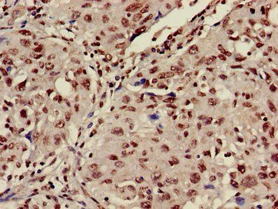 HIST1H3A (Ab-9) Antibody