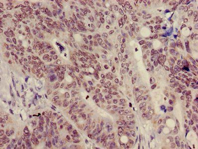 HIST1H3A (Ab-9) Antibody