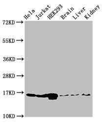 HIST1H3A (Ab-9) antibody