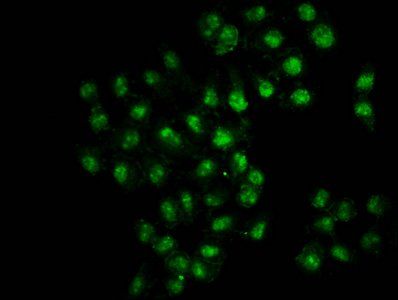 HIST1H3A (Ab-9) antibody