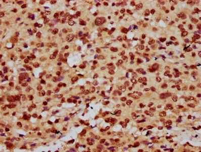 HIST1H3A (Ab-9) Antibody