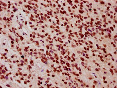 HIST1H3A (Ab-9) Antibody