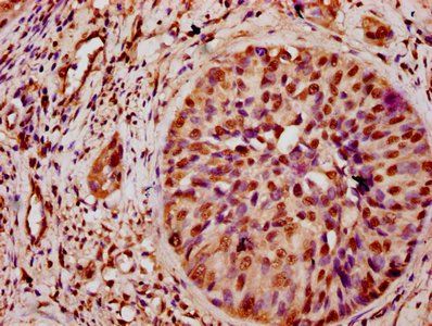HIST1H3A (Ab-9) Antibody