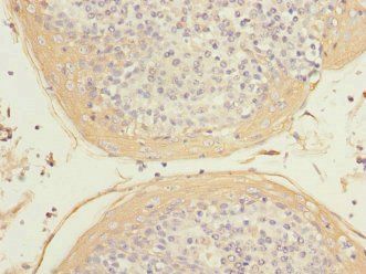 HIST1H3A Antibody