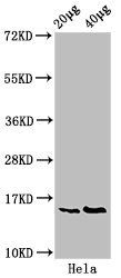Phospho-HIST1H3A (S10) Antibody