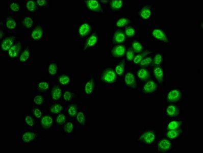 Phospho-HIST1H3A (S28) Antibody