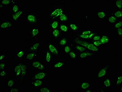 Phospho-HIST1H3A (T80) Antibody