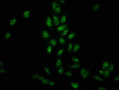 Phospho-HIST1H3A (Y41) Antibody