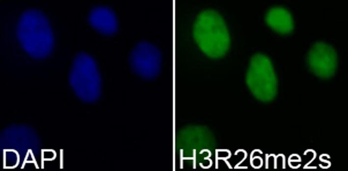 Symmetric DiMethyl-Histone H3-R26 antibody