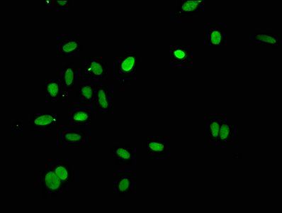 HIST1H4A (Ab-1) Antibody