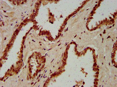 HIST1H4A (Ab-1) Antibody