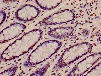 HIST1H4A (Ab-12) Antibody