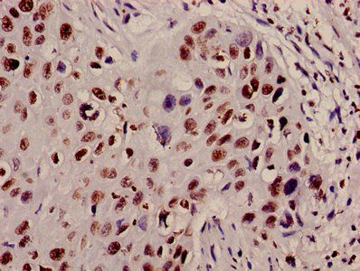 HIST1H4A (Ab-12) Antibody