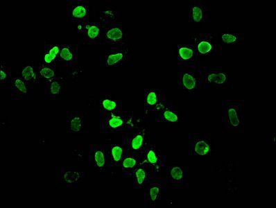 HIST1H4A (Ab-12) Antibody