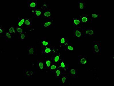 HIST1H4A (Ab-12) antibody