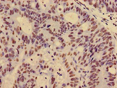 HIST1H4A (Ab-12) Antibody