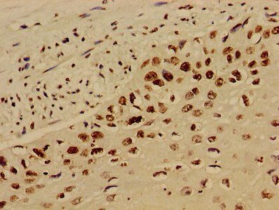 HIST1H4A (Ab-12) Antibody