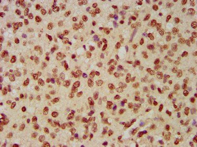 HIST1H4A (Ab-12) Antibody