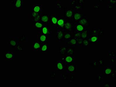 HIST1H4A (Ab-12) Antibody