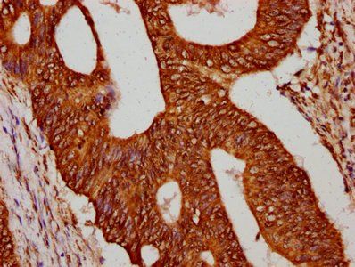 HIST1H4A (Ab-12) Antibody