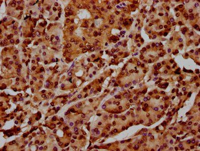 HIST1H4A (Ab-12) Antibody