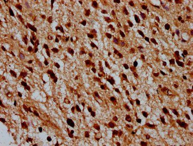 HIST1H4A (Ab-12) Antibody