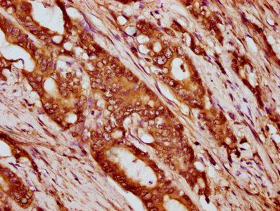HIST1H4A (Ab-12) Antibody