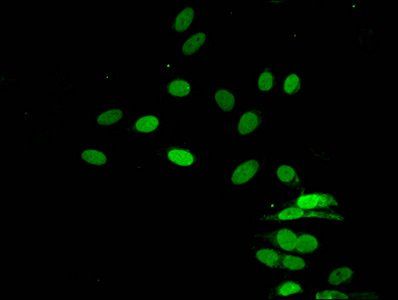 HIST1H4A (Ab-16) antibody