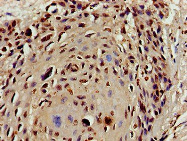 HIST1H4A (Ab-16) Antibody