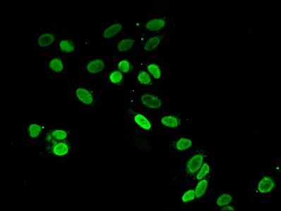 HIST1H4A (Ab-16) antibody