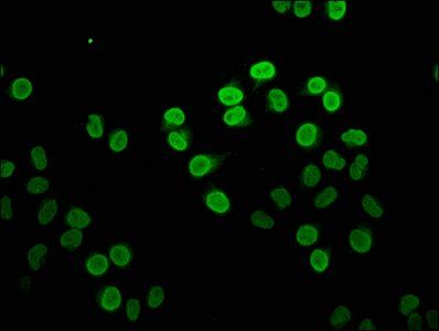 HIST1H4A (Ab-16) antibody