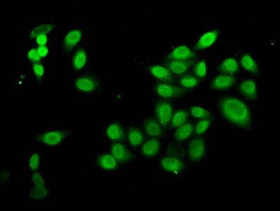 HIST1H4A (Ab-16) antibody