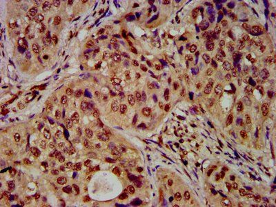 HIST1H4A Antibody