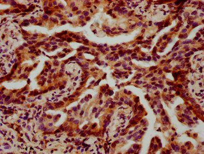 HIST1H4A Antibody