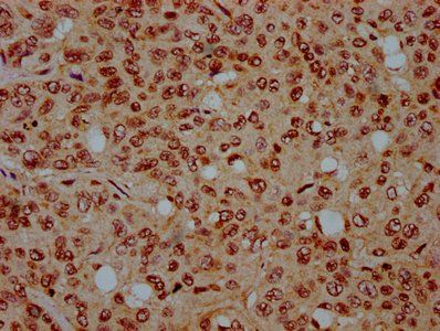 HIST1H4A Antibody