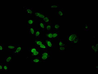 HIST1H4A (Ab-5) antibody