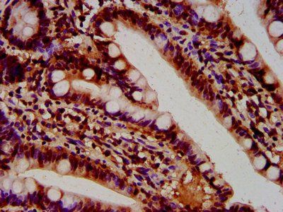 HIST1H4A (Ab-5) Antibody