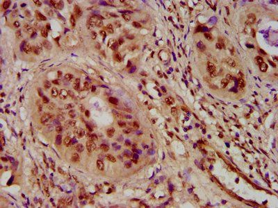 HIST1H4A (Ab-5) Antibody