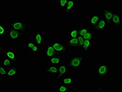HIST1H4A (Ab-5) Antibody