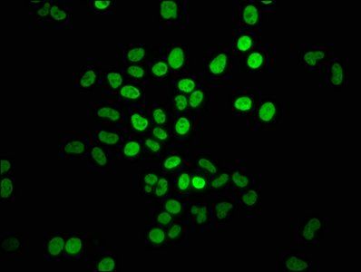 HIST1H4A (Ab-5) antibody