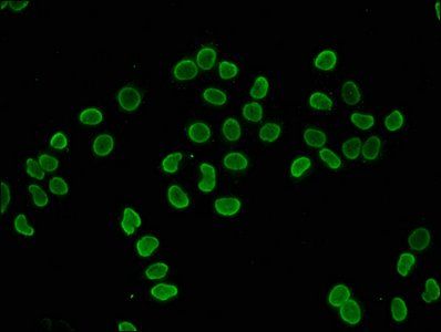 HIST1H4A (Ab-5) antibody