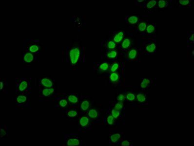 HIST1H4A (Ab-5) antibody