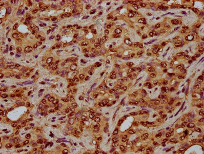 HIST1H4A (Ab-5) Antibody