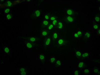 HIST1H4A (Ab-5) Antibody