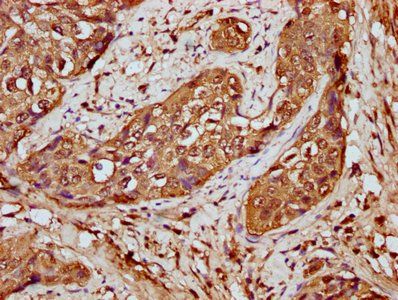 HIST1H4A Antibody